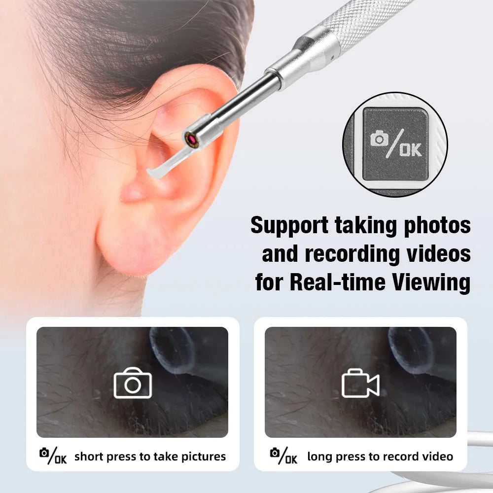 Ear Wax Removal Tool 4.3'' Screen - Digital Ear Camera 6 LED