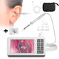 Ear Wax Removal Tool 4.3'' Screen - Digital Ear Camera 6 LED